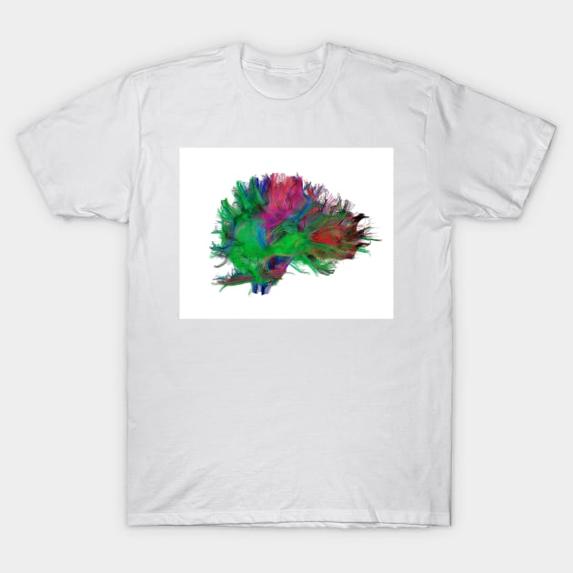 Brain fibres side view right, DTI scan (C038/4665) T-Shirt by SciencePhoto